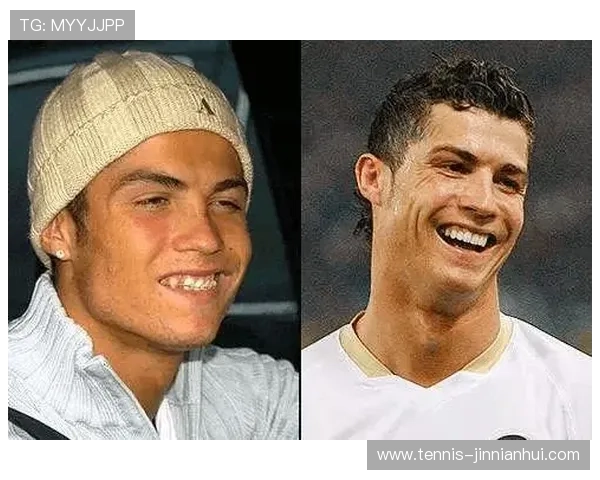 足球球星佩戴牙套改变形象 他们的笑容背后藏着哪些秘密